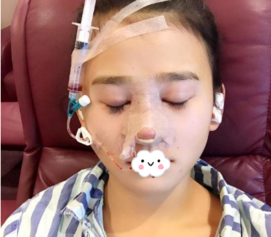 蚌埠韓美美萊整形醫(yī)生歷芳做耳軟骨隆鼻怎么樣？附耳軟骨隆鼻案例對比圖