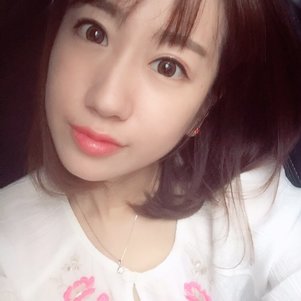 蚌埠韓美美萊整形做玻尿酸面部除皺效果怎么樣？附陳澤醫(yī)生案例效果圖