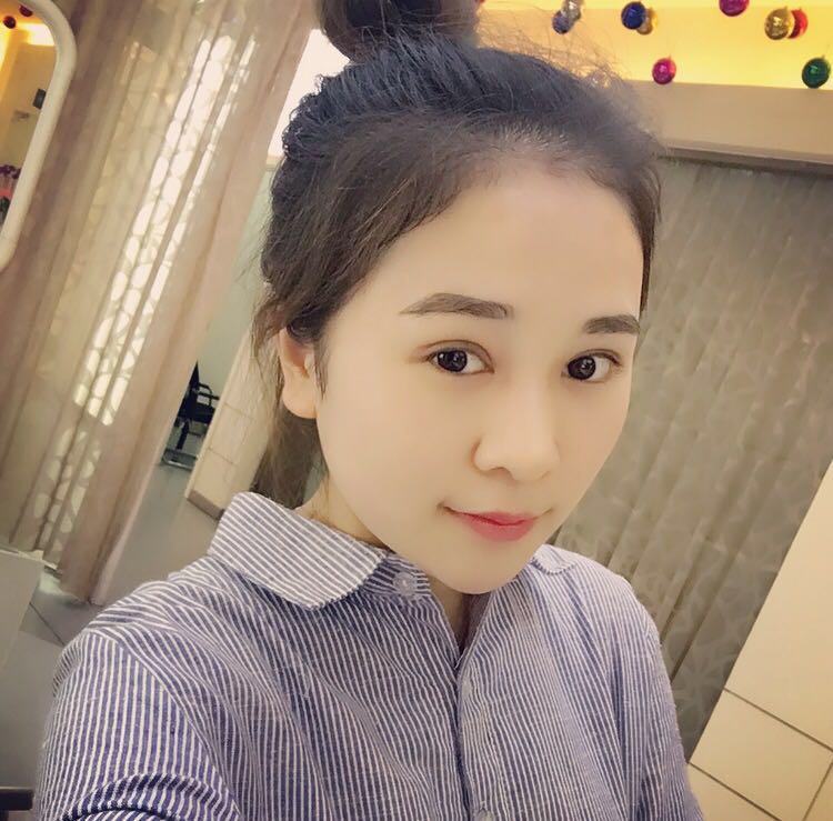 蚌埠韓美美萊整形醫(yī)生鄭捷做開(kāi)眼角怎么樣？附案例效果圖