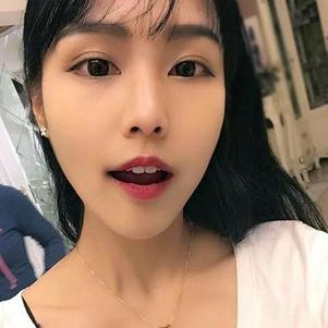 鞍山時代口腔門診部洗牙效果怎么樣？附申元休醫(yī)生洗牙案例效果圖