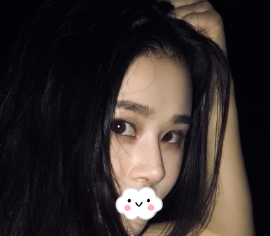 蚌埠韓美美萊整形醫(yī)生歷芳做耳軟骨隆鼻怎么樣？附耳軟骨隆鼻案例對比圖