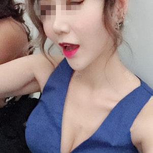 保定杏林中醫(yī)醫(yī)院整形外科醫(yī)生從相文做自體脂肪隆胸效果怎么樣？附隆胸案例