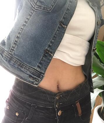 保定現(xiàn)代女子醫(yī)院整形美容中心做腰腹部吸脂怎么樣？附林秀蓮醫(yī)生案例效果圖