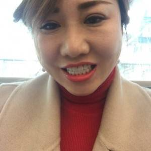 保定東陽(yáng)口腔醫(yī)院趙晨醫(yī)生做瓷貼面怎么樣？附瓷貼面案例效果對(duì)比圖