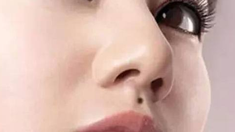 綜合隆鼻價格需要多少錢？價格貴嗎？