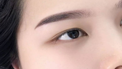 下眼瞼手術(shù)要多久時(shí)間恢復(fù)？一般需要多少錢？