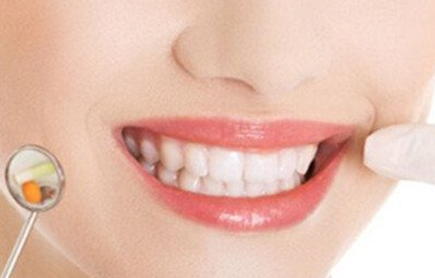 合金烤瓷牙多少錢一個(gè)？?jī)r(jià)錢貴不貴？