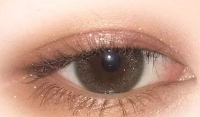 單眼皮割雙眼皮會留疤嗎？單眼皮割雙眼皮幾天恢復(fù)自然？