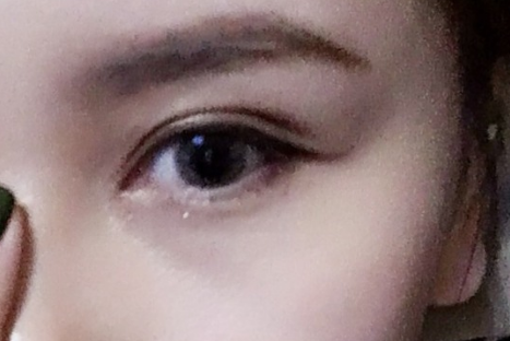 做雙眼皮對眼睛視力有影響嗎？雙眼皮對身體有沒有危害？