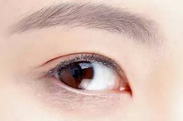 開內(nèi)眼角大概多少錢？開內(nèi)眼角大概需要多久恢復(fù)？