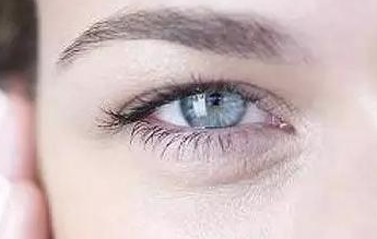 開內(nèi)眼角的弊端有哪些？