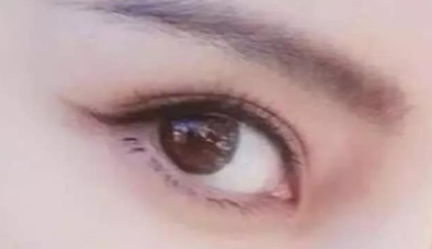 開眼角多久可以完全恢復(fù)？