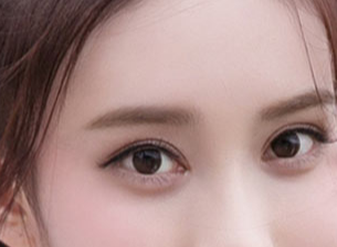 開(kāi)眼角一般需要多少錢？