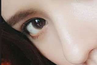 開眼角有害嗎？