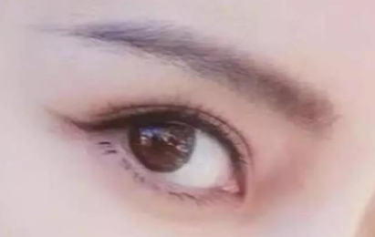 外眼角開大會留疤嗎？