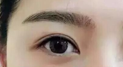 西安割雙眼皮效果好的醫(yī)院有哪幾家？人氣前六盤點！