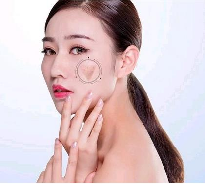 深圳好的祛痘整形醫(yī)院有哪家？名單值得收藏！