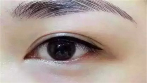 貴陽眼部整形醫(yī)院排名一覽！這10家醫(yī)院實(shí)力人氣口碑具在！