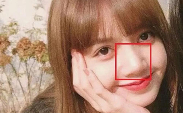 鼻子太大怎么辦？怎么改善大鼻頭