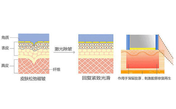 http://www.wawacam.net.cn/news/995.html
