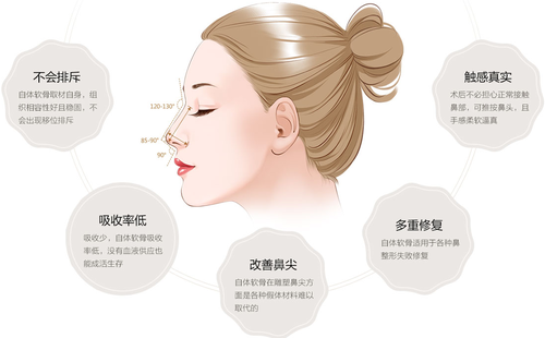 自體軟骨隆鼻可以永久的嗎？
