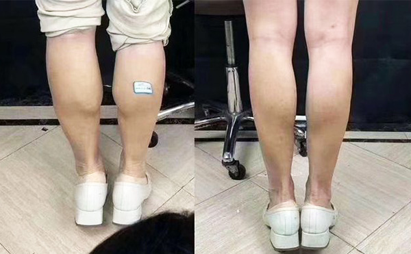 boxo瘦腿好嗎？