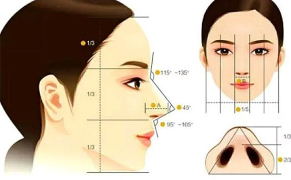 假體隆鼻恢復(fù)期要多長時(shí)間？假體隆鼻不滿意還能做注射隆鼻改善嗎？