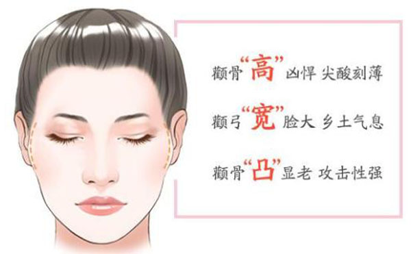 顴骨內(nèi)推整形適宜人群？