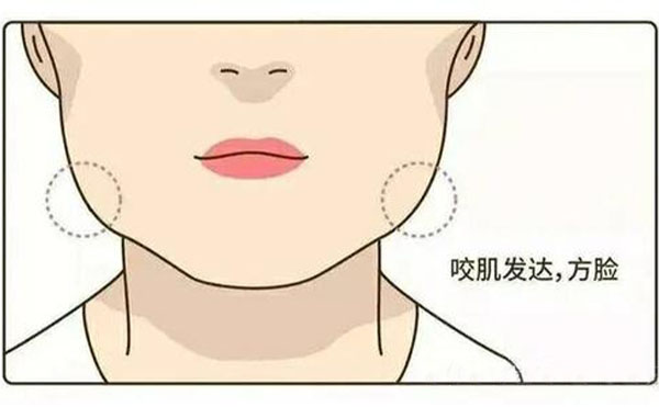 為什么咬肌會肥大？