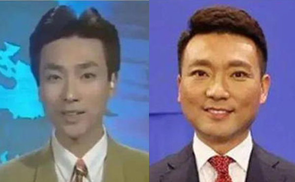 治療咬肌肥大的方法有哪些？