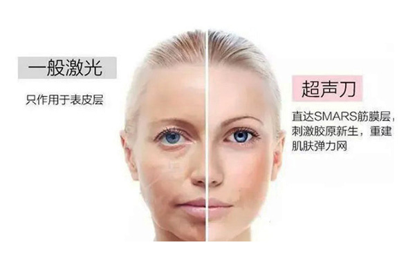 超聲刀有什么優(yōu)勢？