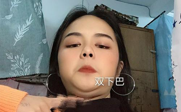 吸脂去雙下巴和溶脂瘦下巴有什么區(qū)別？