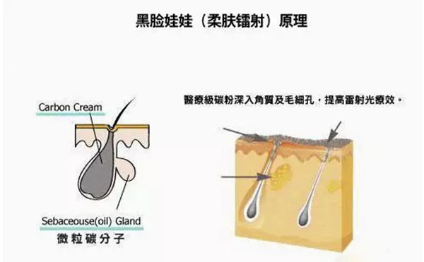 黑臉娃娃是什么？