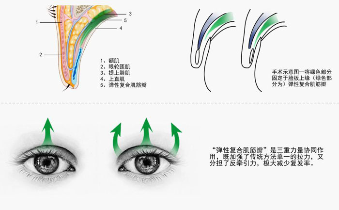 上瞼下垂的癥狀有哪些？