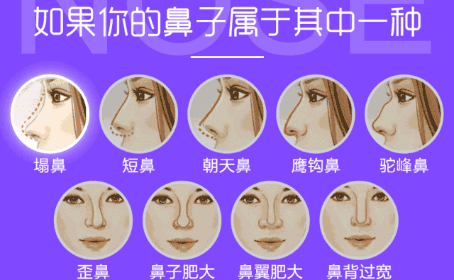 自體脂肪隆鼻可以保持多久？