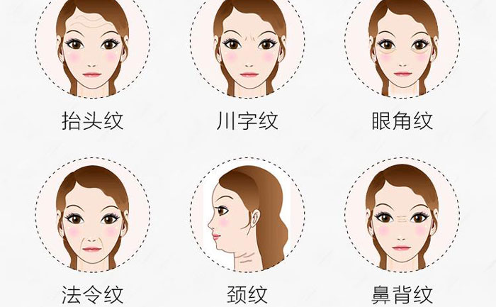 botox除皺針有哪些副作用？