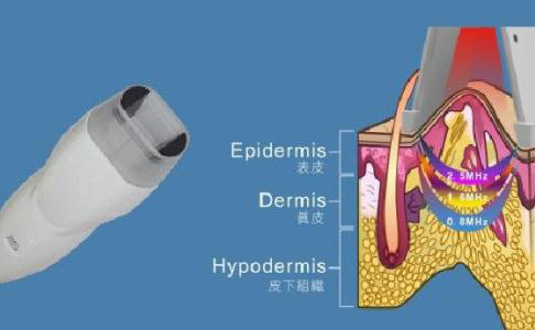 射頻除皺的效果好嗎？