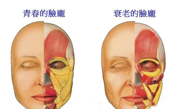 電波拉皮的誤區(qū)？