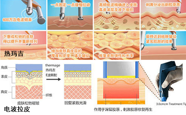 http://www.wawacam.net.cn/news/959.html