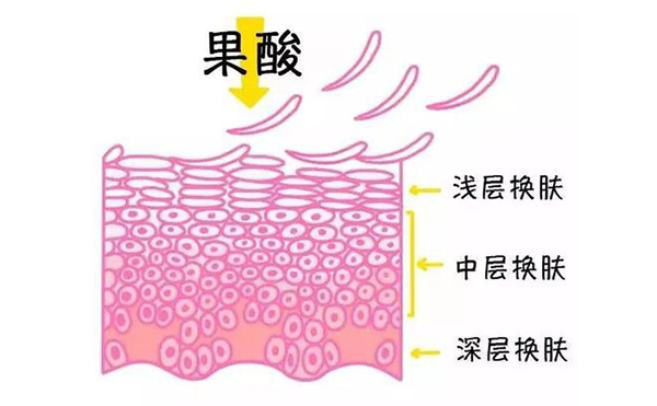 果酸煥膚的作用有哪些？