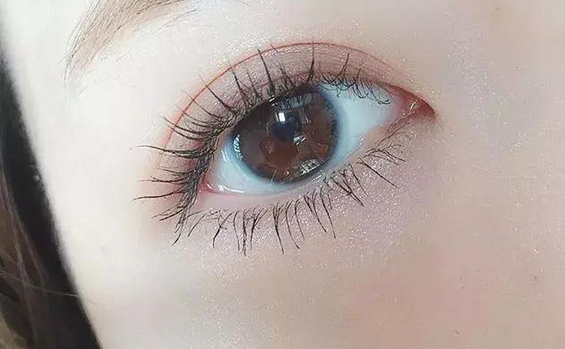 激光雙眼皮手術(shù)多少錢？激光雙眼皮手術(shù)需要多久恢復時間？