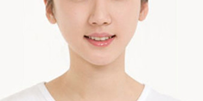 面部吸脂術后