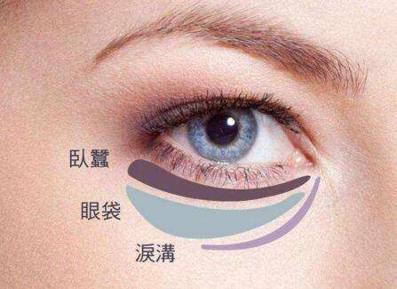 眼袋失敗修復(fù)要怎么處理？切眼袋需要多長時間恢復(fù)？