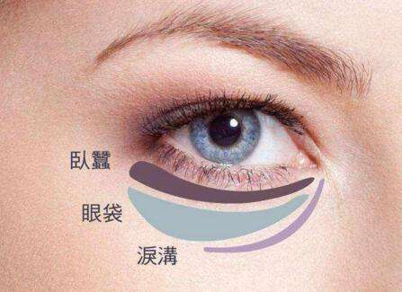 眼袋失敗修復(fù)要怎么處理？切眼袋需要多長(zhǎng)時(shí)間恢復(fù)？