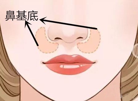 做玻尿酸墊鼻基底風(fēng)險(xiǎn)有哪些？深圳市玻尿酸豐鼻基底大概需要費(fèi)用？