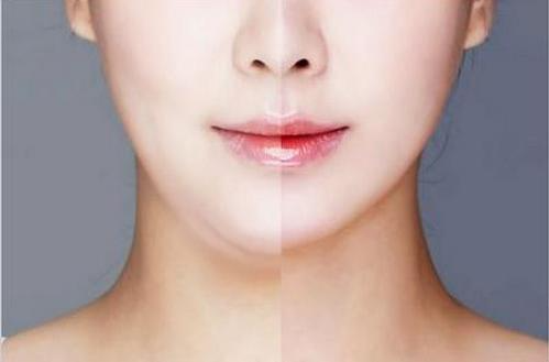 面部吸脂最好的辦法是什么？做一次面部吸脂多少錢(qián)？