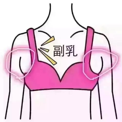 吸脂做副乳要多少錢？吸脂去副乳會反彈嗎？