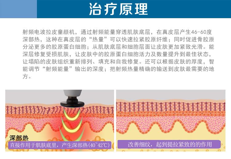  射頻緊膚的效果到底怎么樣呢？射頻緊膚多久做一次？