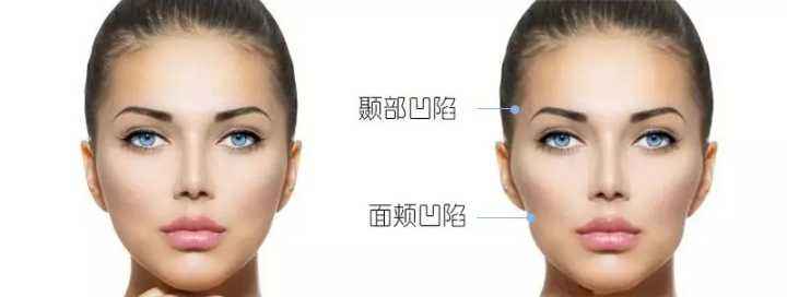 熱瑪吉做一次可以保持多久？熱瑪吉的原理和功效