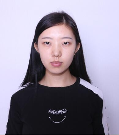做雙眼皮案例，第四軍醫(yī)大學(xué)唐都醫(yī)院李望舟雙眼皮案例圖片